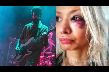 Yüzyüzeyken Konuşuruz'un gitaristine sevgilisini darbettiği iddiası...