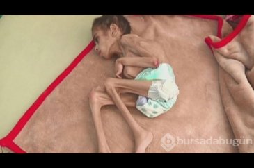  Bu yıl en az 17,6 milyon çocuk aç doğacak!