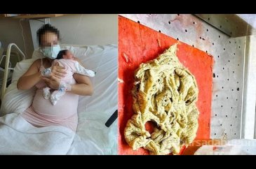 Doğumda annenin vücudunda gazlı bez unutulmasına inceleme
