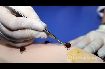 Kene kabusu başladı! Isırıldıktan sonra hemen bu 2 şeyi yapın!