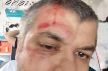 Sinyal verme kavgasının sonu kötü bitti...