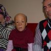 Türkiye'nin ilk yüz nakli küçük Buse'yi umutlandırdı