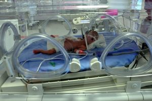 Prematürelere anne kokusuyla tedavi