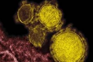 MERS virüsü Ortadoğu'nun kabusu oldu