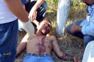 Bayılıncaya kadar kendini doğradı