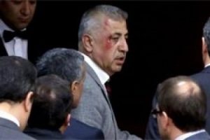 Meclis'te kanlı kavga