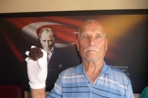 Mesanesinde portakal büyüklüğünde taş çıktı