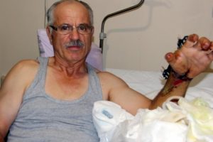 Elini kesti, hiç acı hissetmedi