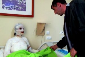 Üzerine kaynar su dökülen 8 çocuk annesi kadın yandı