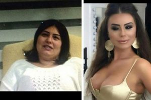 Güzellik uğruna 17 kez bıçak altına yattı, 100 bin lira harcadı