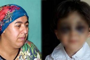 Üvey annesi bu hale getirdi, öz annesi konuştu