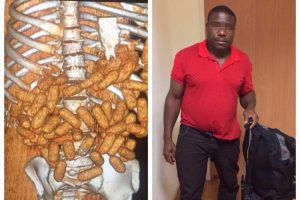 Midesinden 2 kilo uyuşturucu çıktı