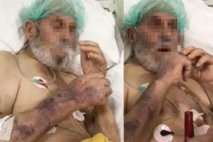 Sakarya'da yoğun bakım rezaletindeki yaşlı adam hayatını kaybetmiş