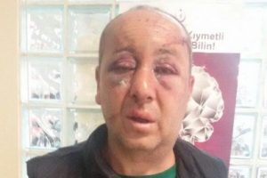 Bursa'da korkunç olay! El ve ayaklarını bağlayıp...