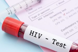HIV virüsünden korkmayın
