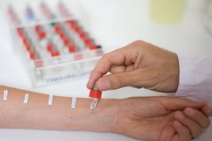 Gıda testlerinde büyük tehlike