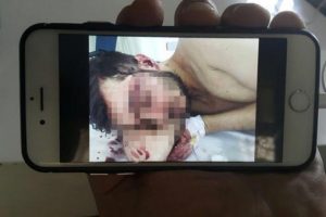 İnternetten tanıştığı iki kişi oklavayla döverek hastanelik etti