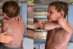 Adana'da hiperimmunglobulin hastası Halil Çiftçi'nin dramı yürek yakıyor!