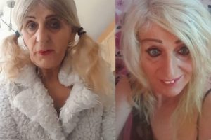 Melissa Ede piyangodan çıkan tüm parayı estetiğe harcadı!