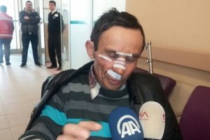 Korkunç kazayı anlattı