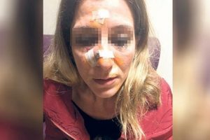 Koruma kararının bitmesini bekledi öldürmeye çalıştı