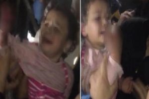 Asansör faciasından küçük çocuğun parmakları koptu!