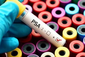 Prostat tedavileri cinselliği bitirmiyor