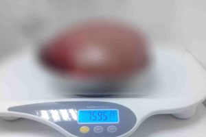 Karnından çıktı! Tam 7,5 kilo ağırlığında...
