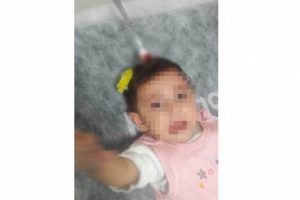 8 aylık bebeğin kafasına çatal saplandı!