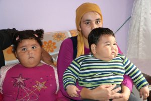 Ayda 3 kilo alan kardeşler yardım bekliyor