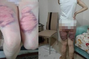 Eşini bu hale getiren koca hakkında flaş karar!
