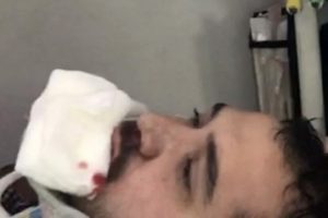 Seçim aracının şoförü darp edildi