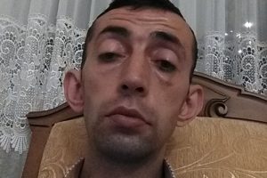 Halk otobüsünün çarptığı bisiklet sürücüsü öldü