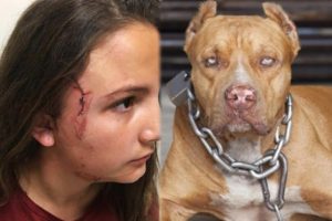 Çocuk parkında pitbul dehşeti!
