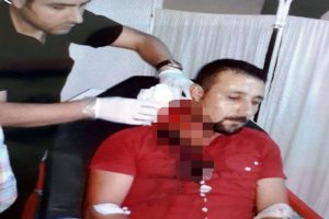 Sağlık memuru falçatayla saldırdı