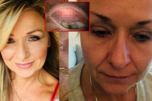 25 yıl boyunca yüzünü yıkamayan kadın doktorları bile şoke etti!