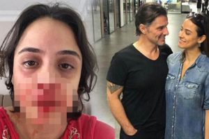 Ünlü oyuncu nişanlısı Zeynep Tandoğan'ı bu hale getirdi!