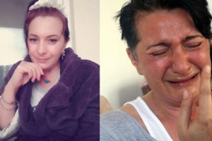 32 dişini birden kaybetmişti! Sinir uçları kesildi