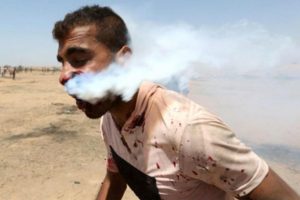 İşte ağzına gaz bombası isabet eden Filistinli'nin sağlık durumu