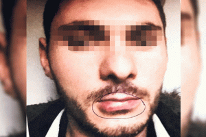 Servis şoförü dehşeti! Dudağını ısırınca kurtuldu