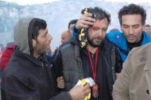 Ünlü oyuncu hayranının kocası tarafından darp edildi