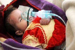 Yemen'de kolera can almaya devam ediyor