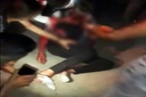 Havai fişek gencin elinde patladı!