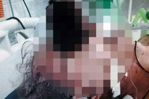 Korkunç olay! Gözüne tuvalet fırçası saplanan adam...