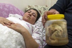 Karnında 1.8 kilo gazlı bez unutmuşlardı, hastane ve doktor suçlu bulundu