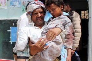 BM Yemen'de çoğu çocuk 50 kişinin öldüğü saldırıyı kınadı