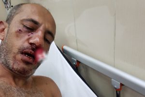 Ortağını 2 kişi ile dövüp bıçakladı