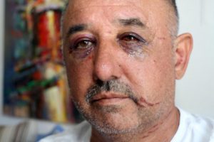 Hayvansever çifti dövdüğü iddia edilmişti... 'Asıl dövülen benim'