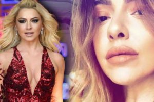 Hadise'nin dudakları şişti