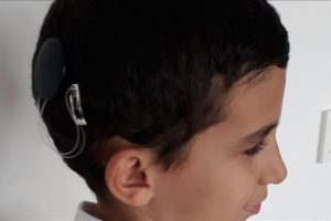İşitme engelini ameliyat ve eğitimle aştı